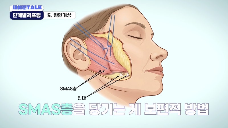 [제이준성형외과·피부과] 보톡스부터 안면거상까지, 내 처짐 수준에 맞는 리프팅 선택법 사진 26